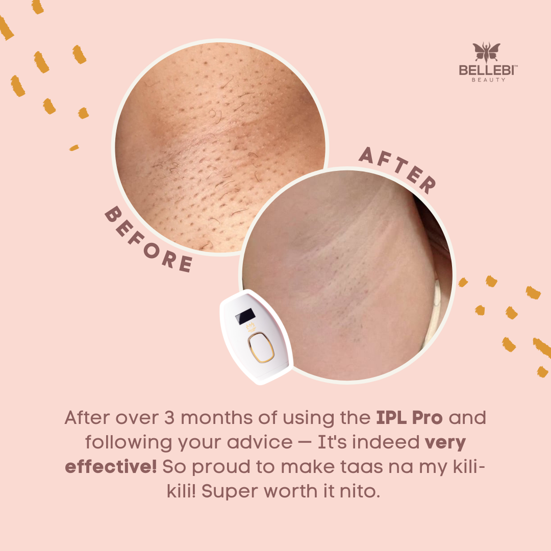 After over 3 months of using the IPL Pro and following your advice. It is indeed very effective!